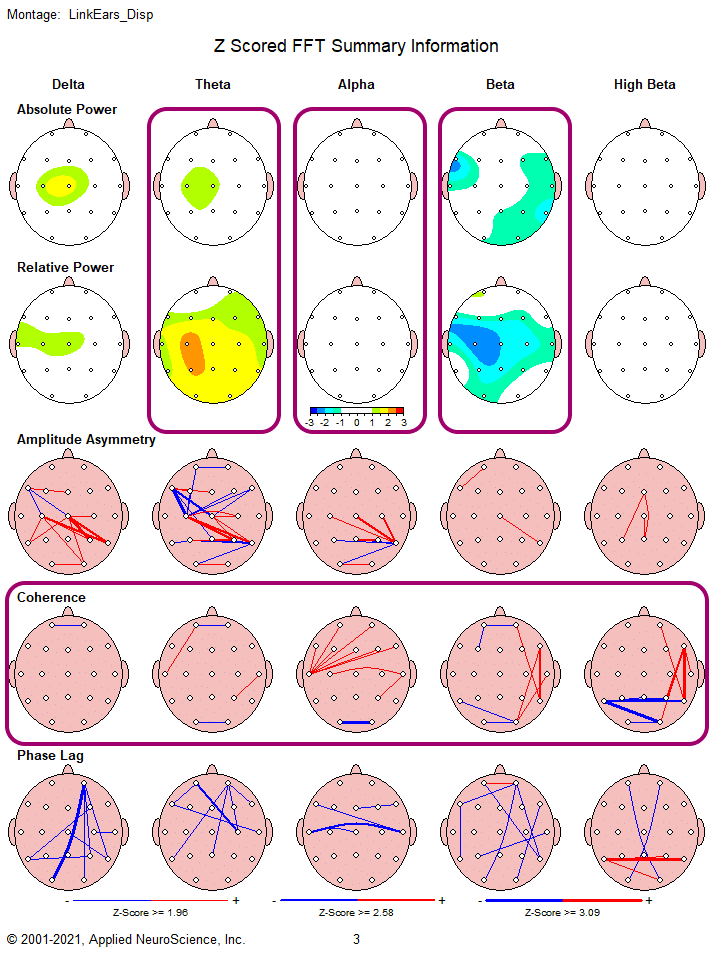 qEEG brain map after neurofeedback training — showing normalized brain activity