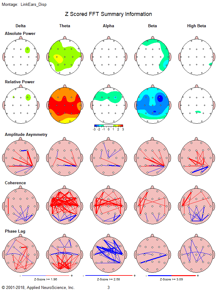 qEEG brain map before neurofeedback training — showing areas of dysregulation